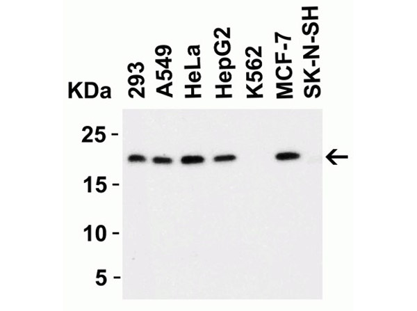 Western Blot Validation of Anti-PERP