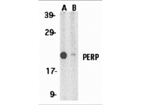 Western Blot Validation of Anti-PERP