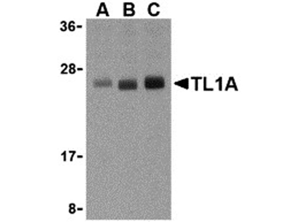 Western blot analysis of TL1A