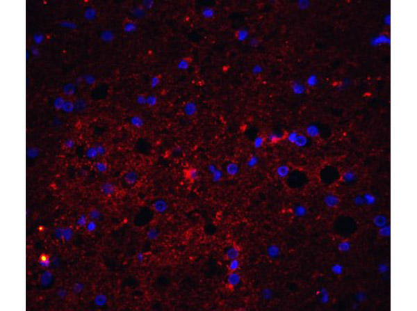 Immunofluorescence of TRAIL