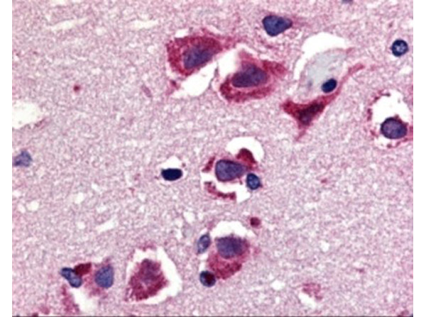 Immunohistochemistry of TRAIL