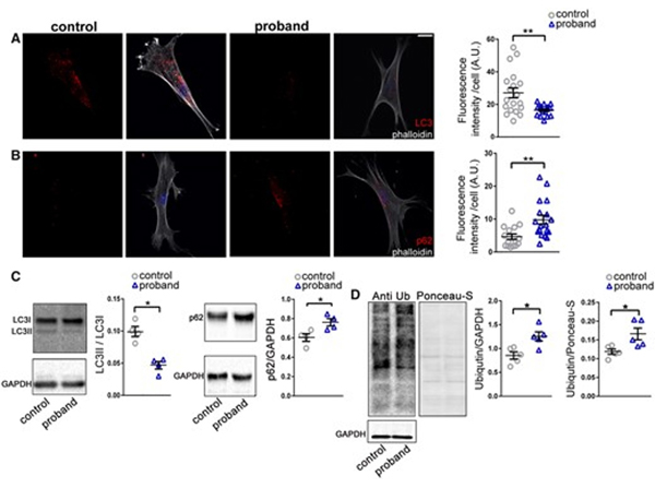 Immunofluorescence using ATG8