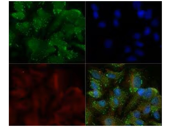 Immunocytochemistry/Immunofluorescence analysis of Anti-DR5