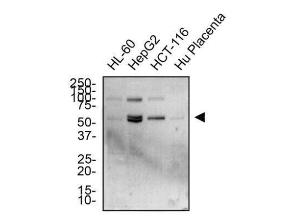 Western Blot analysis of Anti-DR5