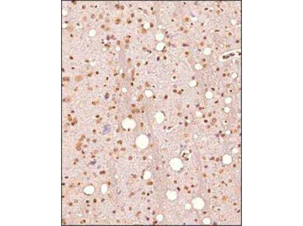 Immunohistochemistry analysis of Anti-Nur77