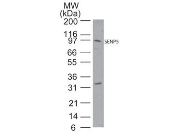 SENP5 Western Blot