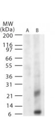 WNVM Western Blot