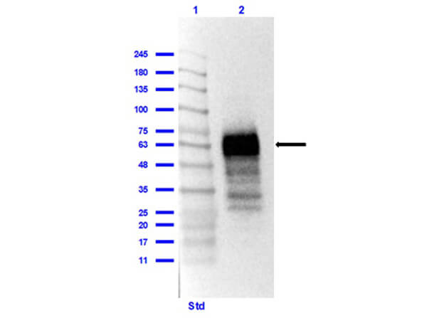 Western Blot Results of Rabbit Anti-SARS CoV-2 Nucleocapsid (N) Protein Antibody