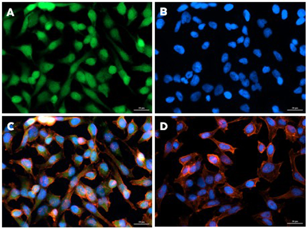 Immunofluorescence using Rabbit Anti-AKT Antibody