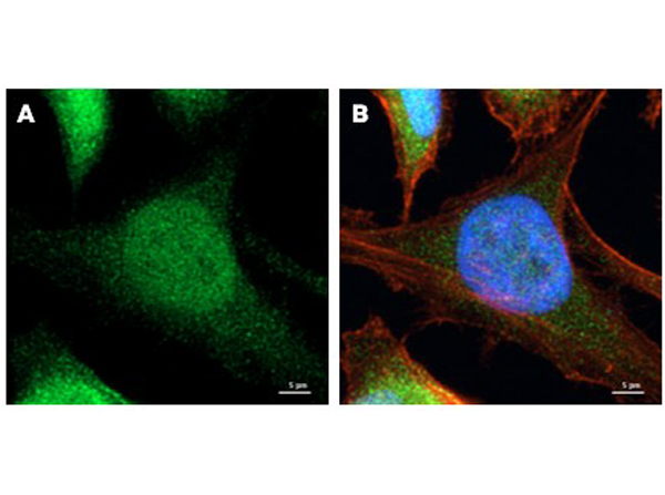 Immunofluorescence using Rabbit Anti-AKT Antibody