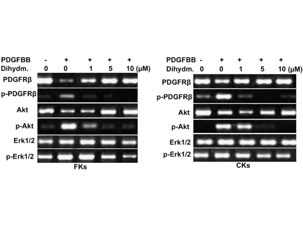 Western Blot using AKT