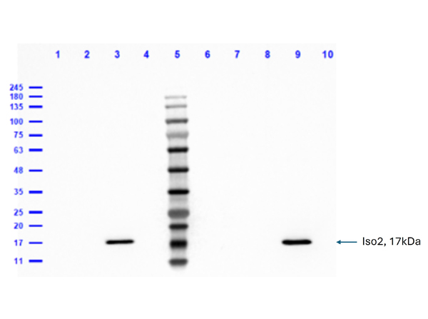 Western blot analysis of Anti-Feimin (isoform 2)