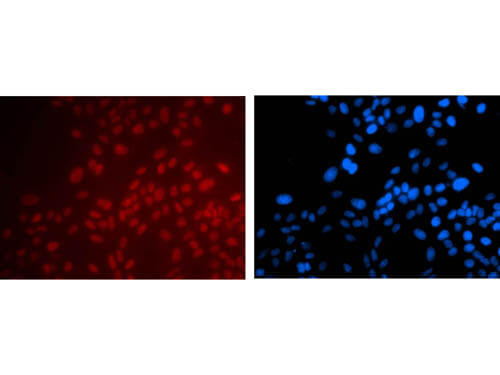 Immunofluorescence Microscopy of Mouse anti-PAX6 antibody.