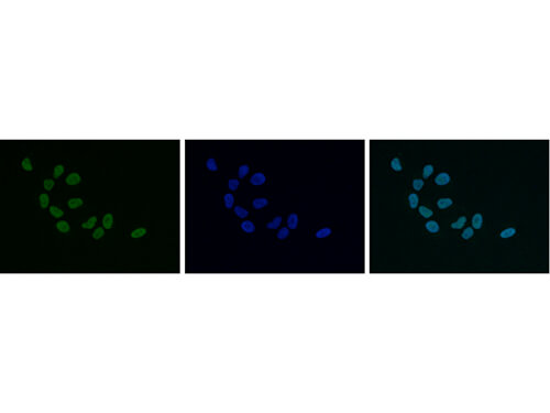 Immunofluorescence Microscopy of anti-HP1 alpha, beta, gamma antibody