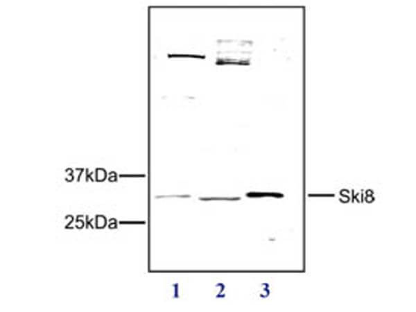 Western Blot of Rabbit anti-SKI8 antibody
