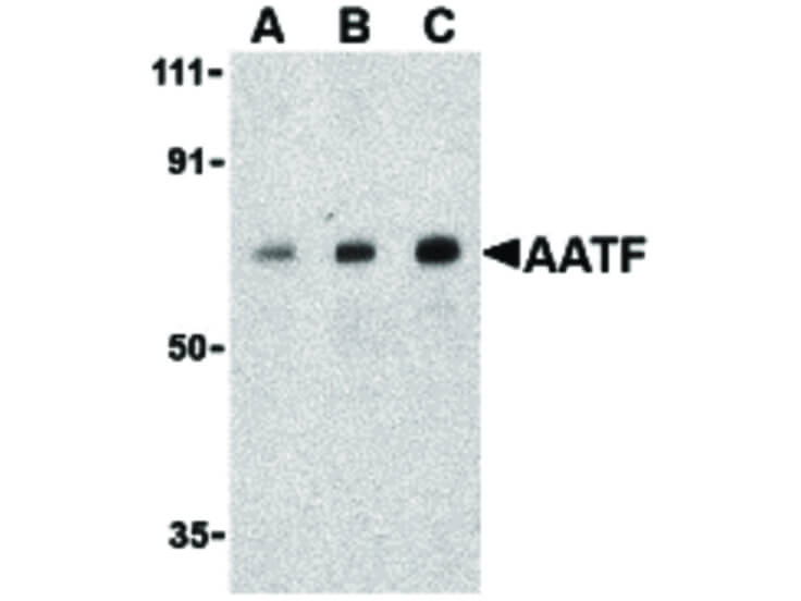 Western Blot of AATF Antibody