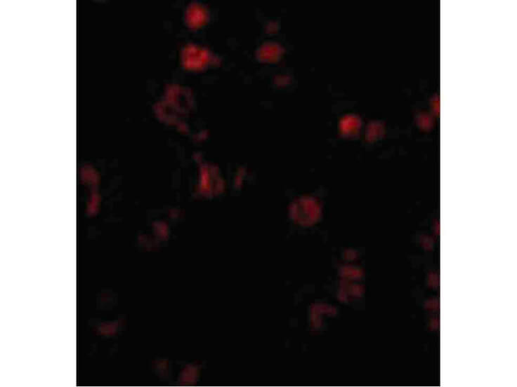 Immunofluorescence of AATF Antibody