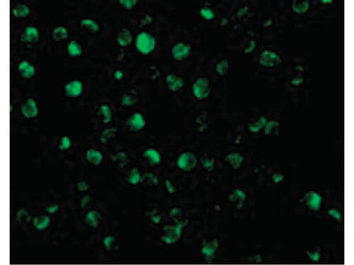 Immunofluorescence of AIF Antibody