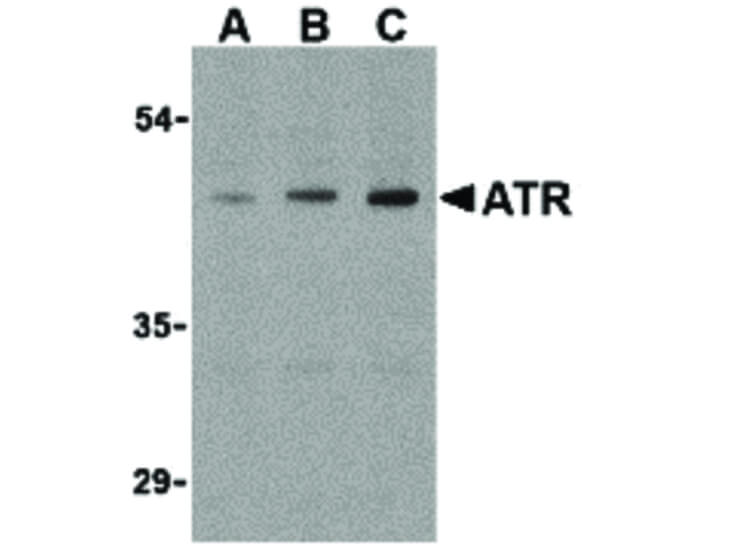 Western Blot of ATR Antibody