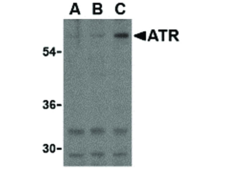 Western Blot of ATR Antibody
