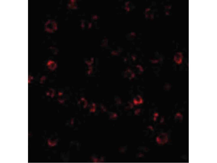 Immunofluorescence of ATR Antibody