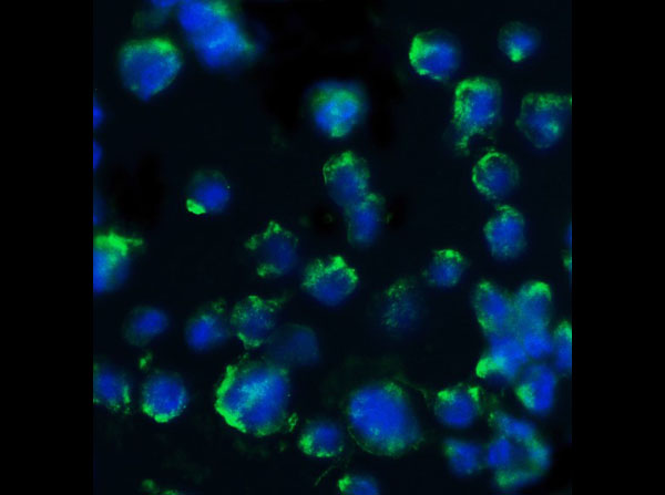 Immunofluorescence of Rabbit Anti-BACE Antibody