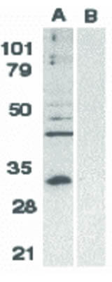 Western Blot of Bcl-10 Antibody