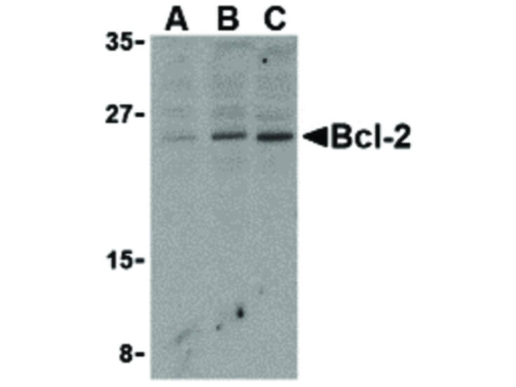 Western Blot of Bcl-2 Antibody