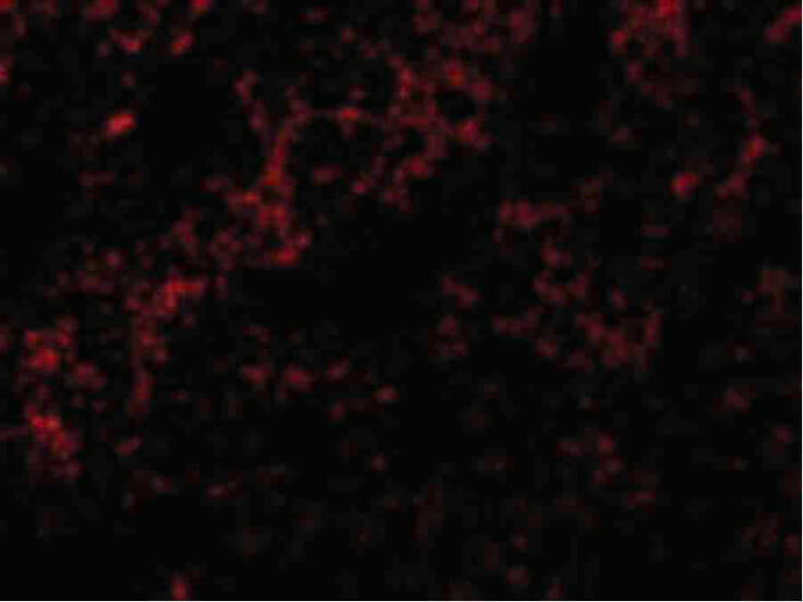 Immunofluorescence of Bid Antibody