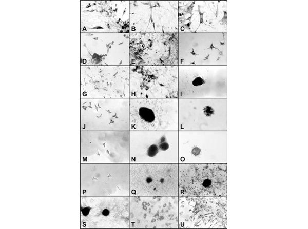 Immunostaining using Beta Galactosidase