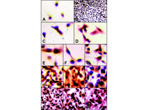 Immunostaining using Beta Galactosidase