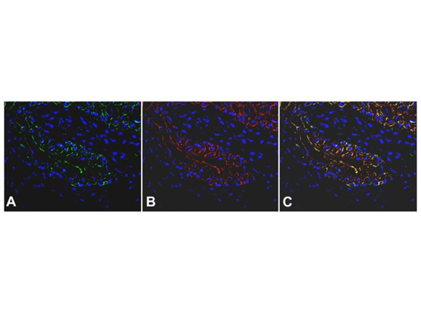 Immunostaining using Beta Galactosidase
