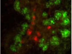 Double immunofluorescence microscopy - anti-Elastase antibody and anti-Insulin antibody