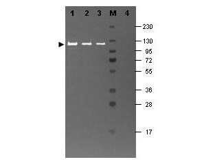Anti-Beta Galactosidase (E.coli) Antibody Fluorescein Conjugated - Western Blot