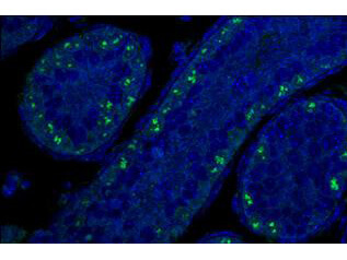 Anti-p19Arf Antibody - Immunofluorescence Microscopy