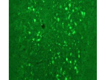Immunofluorescence Microscopy of Anti-Calretinin (Sheep) Antibody