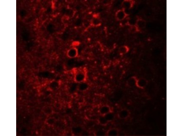 Immunofluorescence of CCDC55