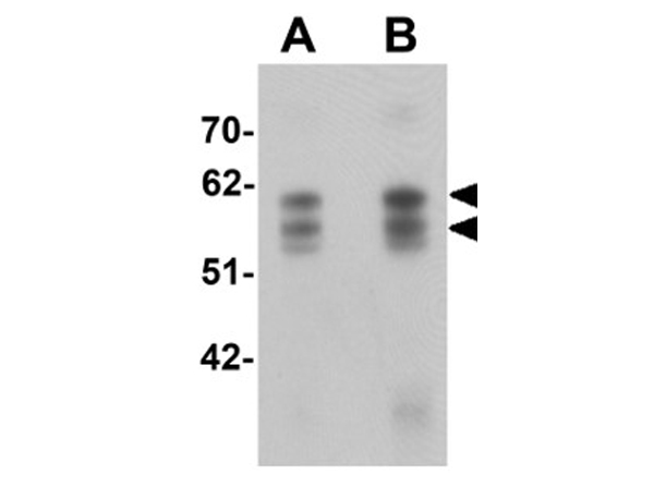 Western blot analysis of CCDC55