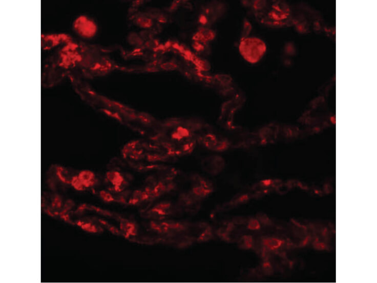 Immunofluorescence of CCDC69 Antibody