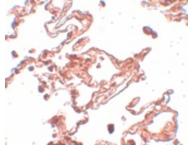 Immunohistochemistry of CCDC69 Antibody