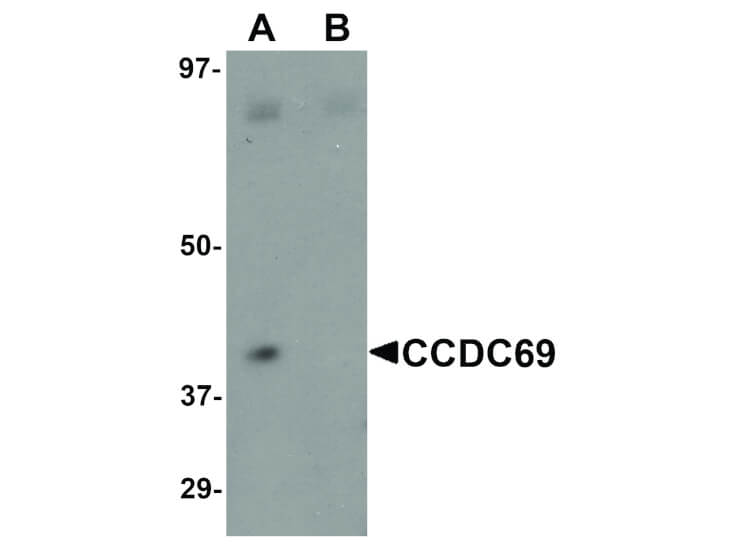 Western Blot of CCDC69 Antibody