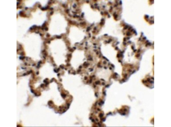 Immunohistochemistry of ECRG2