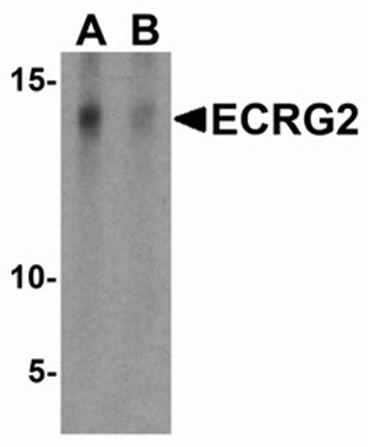 Western blot analysis of ECRG2