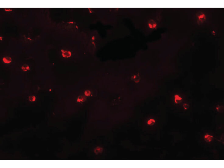 Immunofluorescence of ENC-2 Antibody