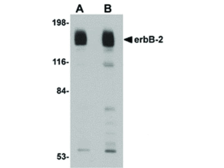 Western Blot of erbB-2 Antibody