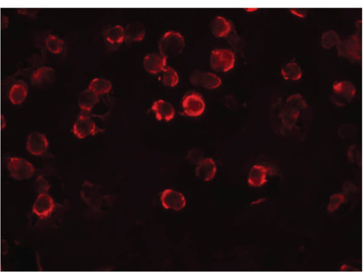 Immunofluorescence of FAM82A1 Antibody