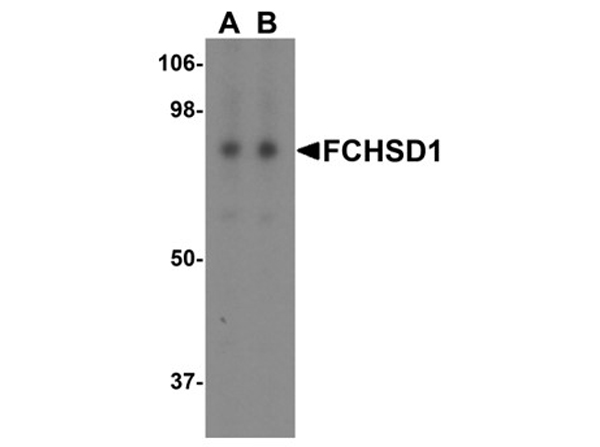 Western blot analysis of FCHSD1
