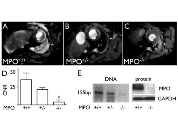 Western Blot using GAPDH