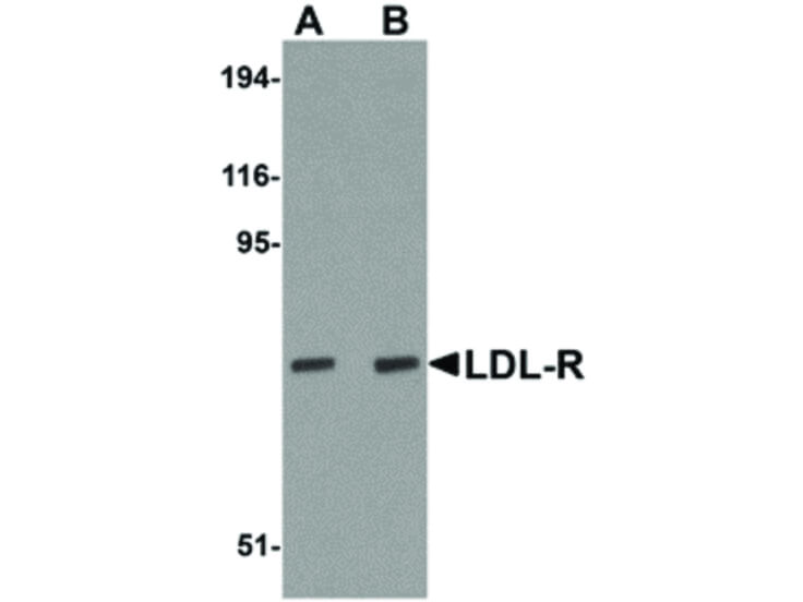Western Blot of LDL-R Antibody