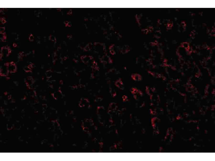 Immunofluorescence of LDL-R Antibody